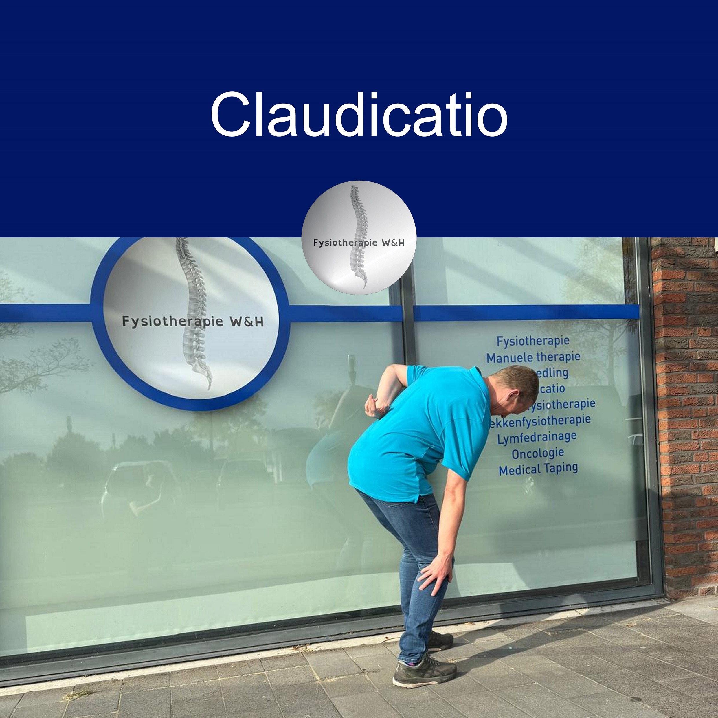 Claudicatio